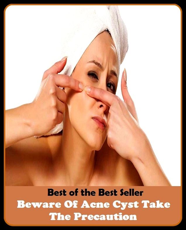 Best of the Best Sellers Beware Of Acne Cyst Take The Precaution(blackheads,pimples,pustules,rosacea,zits, whiteheads, skin inflammation, pizza face, tumor, eruption)