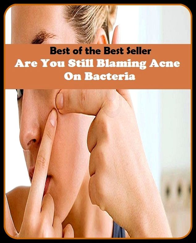 Best of the Best Sellers Are You Still Blaming Acne On Bacteria(blackheads,pimples,pustules,rosacea,zits, whiteheads, skin inflammation, pizza face, tumor, eruption)