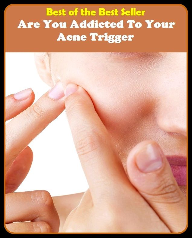 Best of the Best Sellers Are You Addicted To Your Acne Trigger(blackheads,pimples,pustules,rosacea,zits, whiteheads, skin inflammation, pizza face, tumor, eruption)