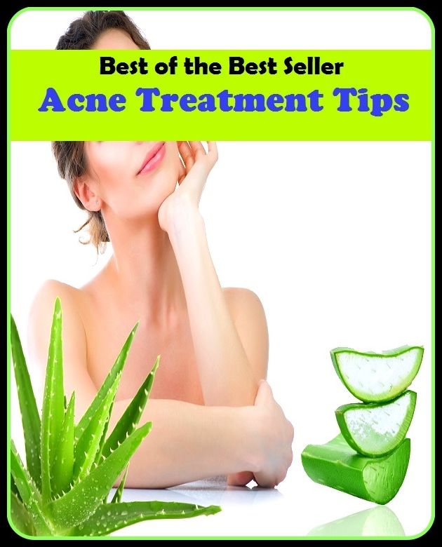 Best of the Best Sellers Acne Treatment Tipsacne:(blackheads,pimples,pustules,rosacea,zits, whiteheads, skin inflammation, pizza face, tumor, eruption)