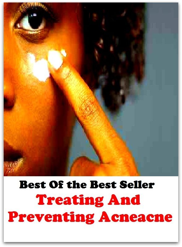 Best of the Best Sellers Treating And Preventing Acneacne : (blackheads,pimples,pustules,rosacea,zits, whiteheads, skin inflammation, pizza face, tumor, eruption)