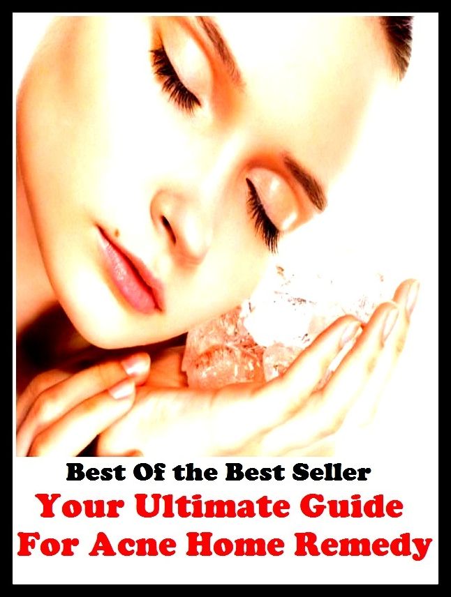 Best of the Best Sellers Your Ultimate Guide For Acne Home Remedy (antidot, pill, fix, relief, therapy, treatment, assistance, drug, salve, amends)