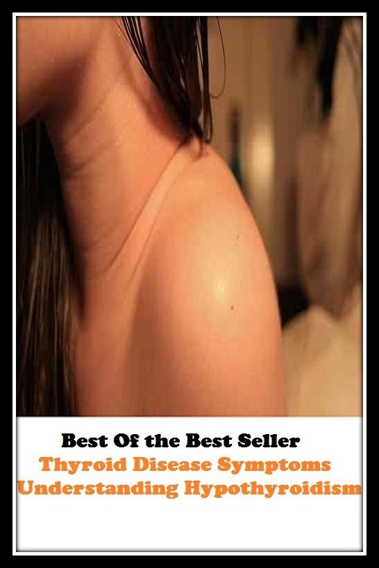 Best of the best seller Thyroid Disease Symptoms Understanding Hypoth(energy,fitness,strength,well-being,bloom,complexion,constitution,euphoria,fettle,form)