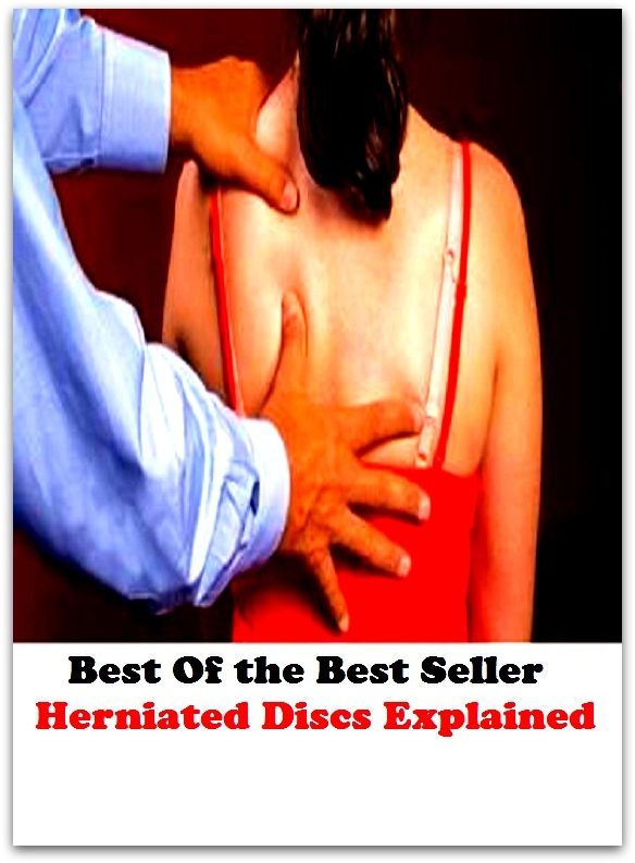 Best of the best seller Herniated Discs Explained(energy,fitness,strength,well-being,bloom,complexion,constitution,euphoria,fettle,form)