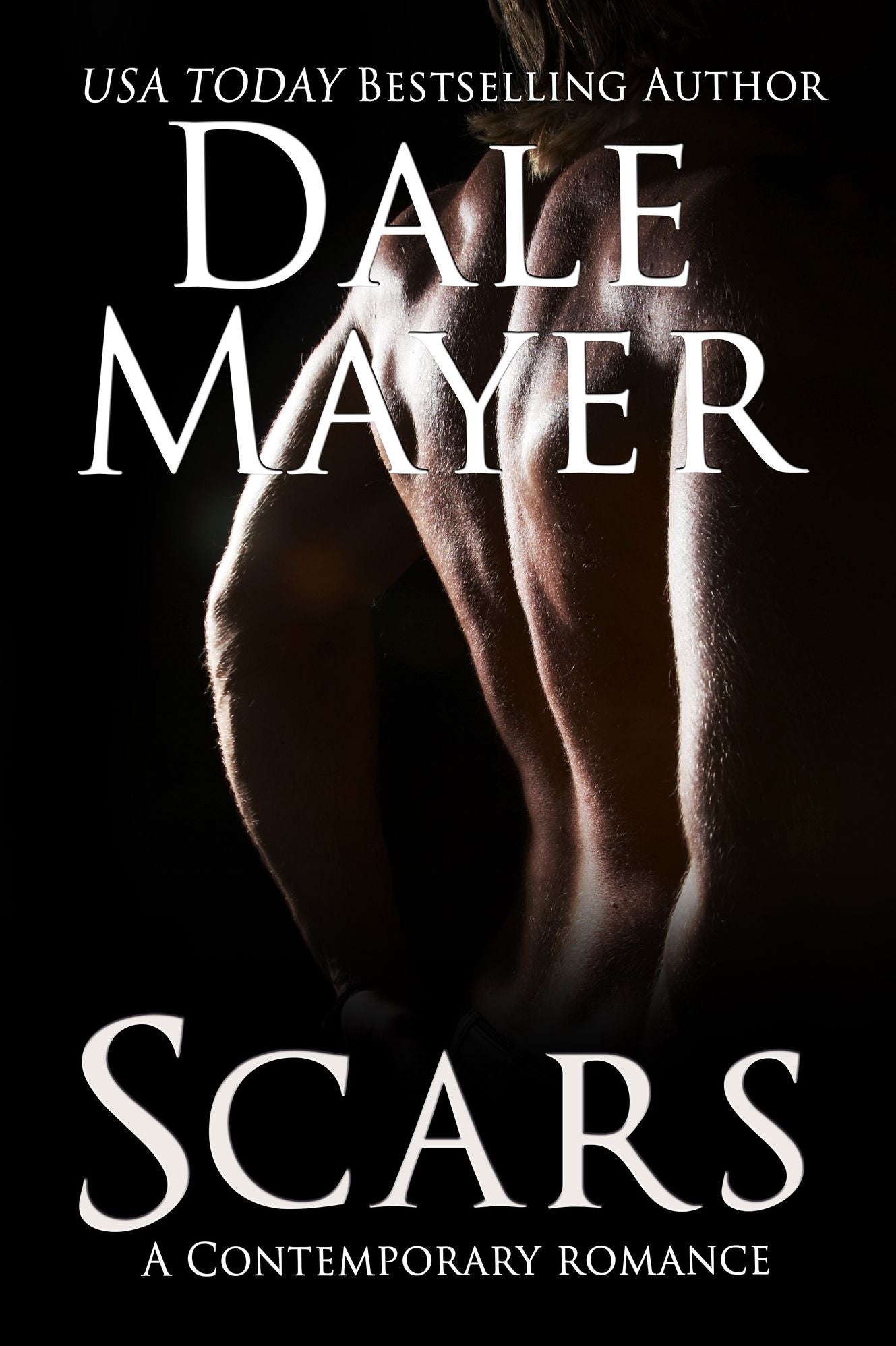 Scars