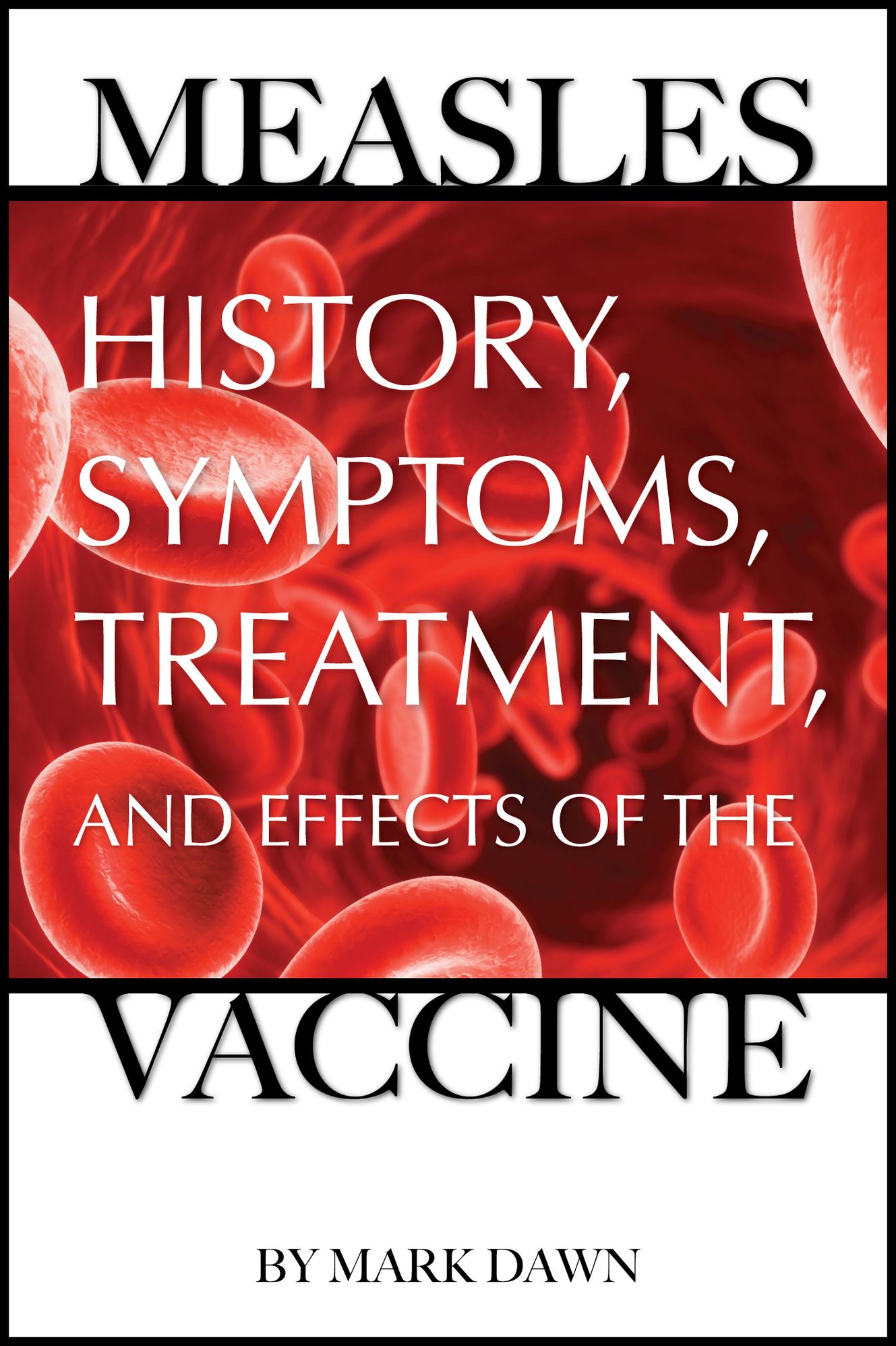 Measles: History, Symptoms, Treatment, and Effects of the Vaccine