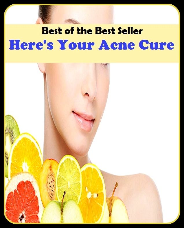 Best of the Best Sellers Here S Your Acne Cure Harry Potter(blackheads,pimples,pustules,rosacea,zits, whiteheads, skin inflammation, pizza face, tumor, eruption)