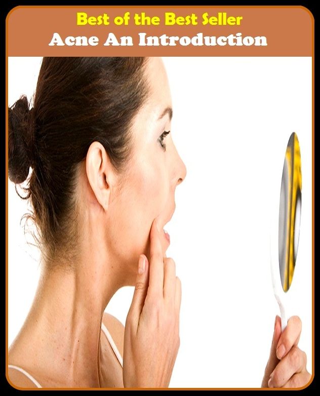 Best of the Best Sellers Acne An Introduction (blackheads,pimples,pustules,rosacea,zits, whiteheads, skin inflammation, pizza face, tumor, eruption)