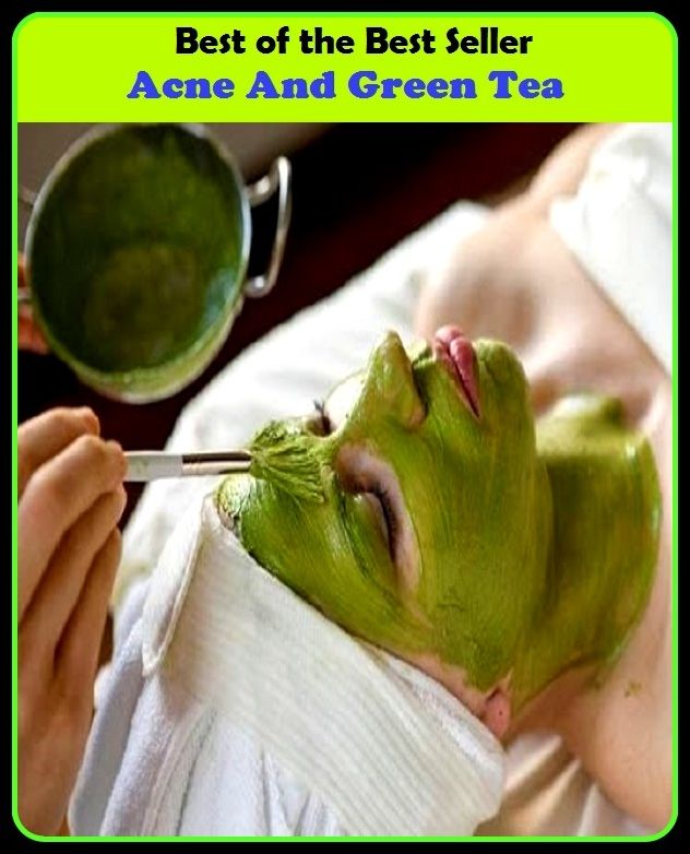 Best of the Best Sellers Acne And Green Tea (blackheads,pimples,pustules,rosacea,zits, whiteheads, skin inflammation, pizza face, tumor, eruption)