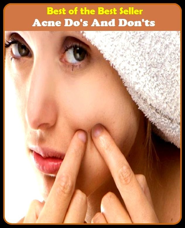 Best of the Best Sellers Acne Dos And Don'ts (blackheads,pimples,pustules,rosacea,zits, whiteheads, skin inflammation, pizza face, tumor, eruption)