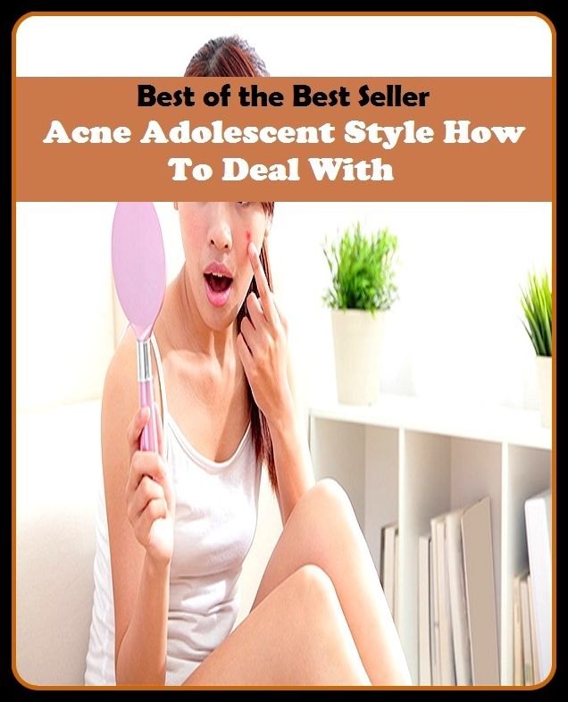 Best of the Best Sellers Acne Adolescent Style How To Deal With (blackheads,pimples,pustules,rosacea,zits, whiteheads, skin inflammation, pizza face, tumor, eruption)