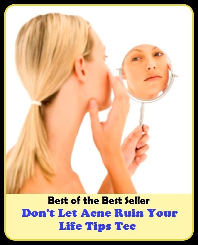 Best of the Best Sellers Don T Let Acne Ruin Your Life Tips Tec (blackheads,pimples,pustules,rosacea,zits, whiteheads, skin inflammation, pizza face, tumor, eruption)