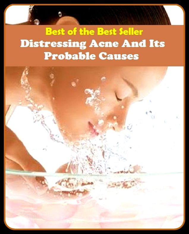 Best of the Best Sellers Distressing Acne And Its Probable Causes (blackheads,pimples,pustules,rosacea,zits, whiteheads, skin inflammation, pizza face, tumor, eruption)