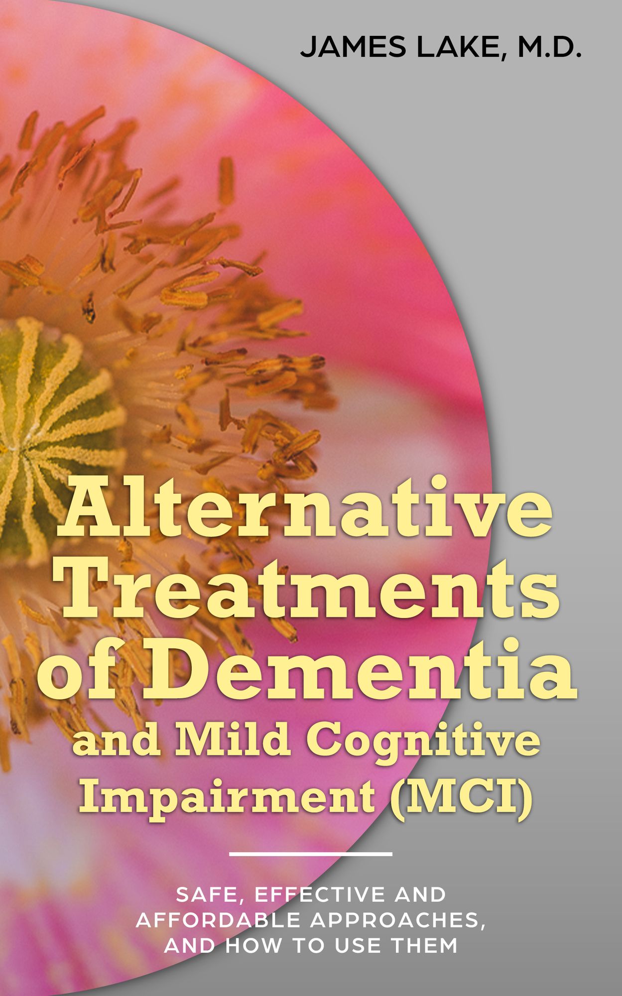 Alternative Treatments of Dementia and Mild Cognitive Impairment (MCI): Safe, Effective and Affordable Approaches and How to Use Them