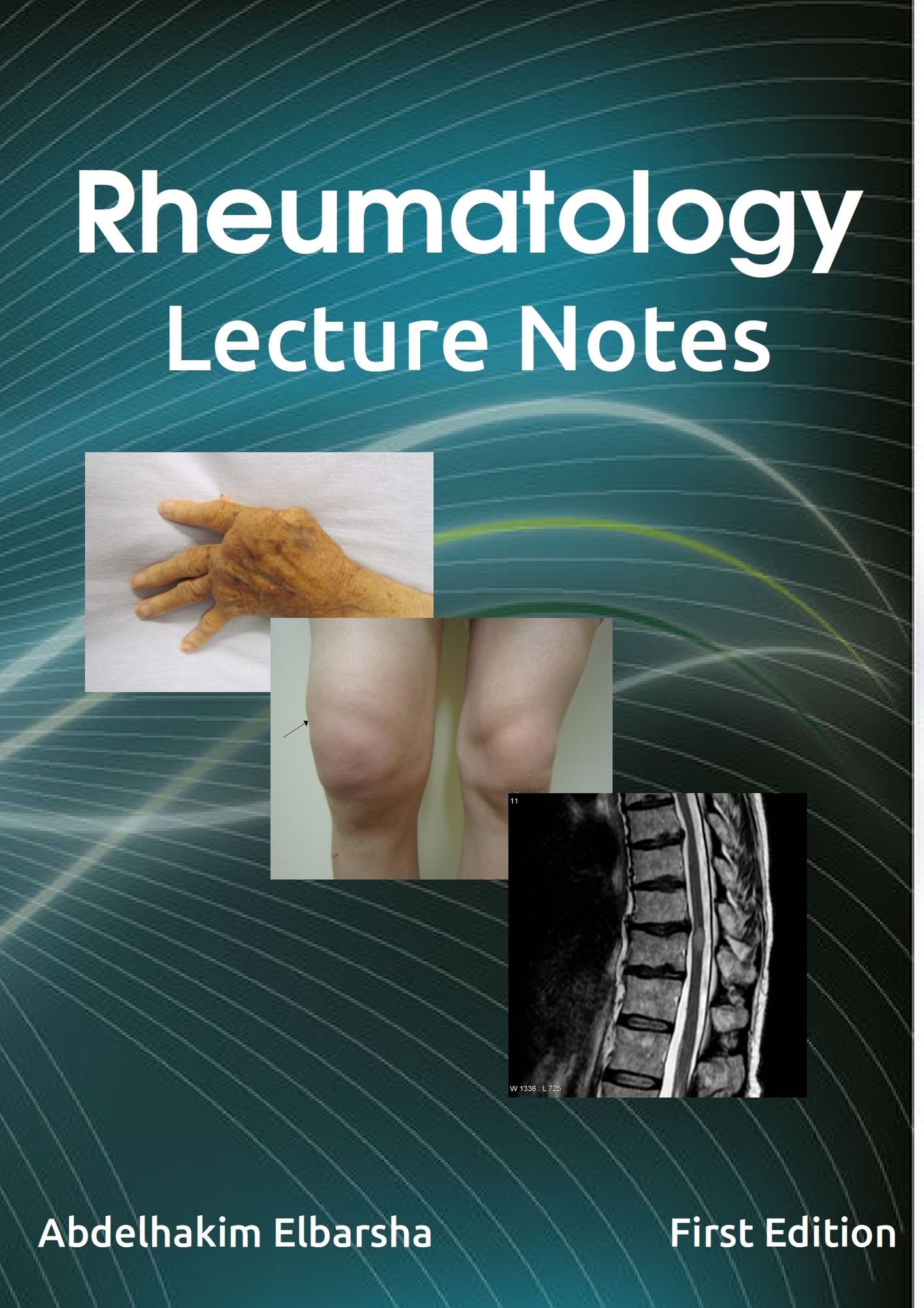 Rheumatology Lecture Notes