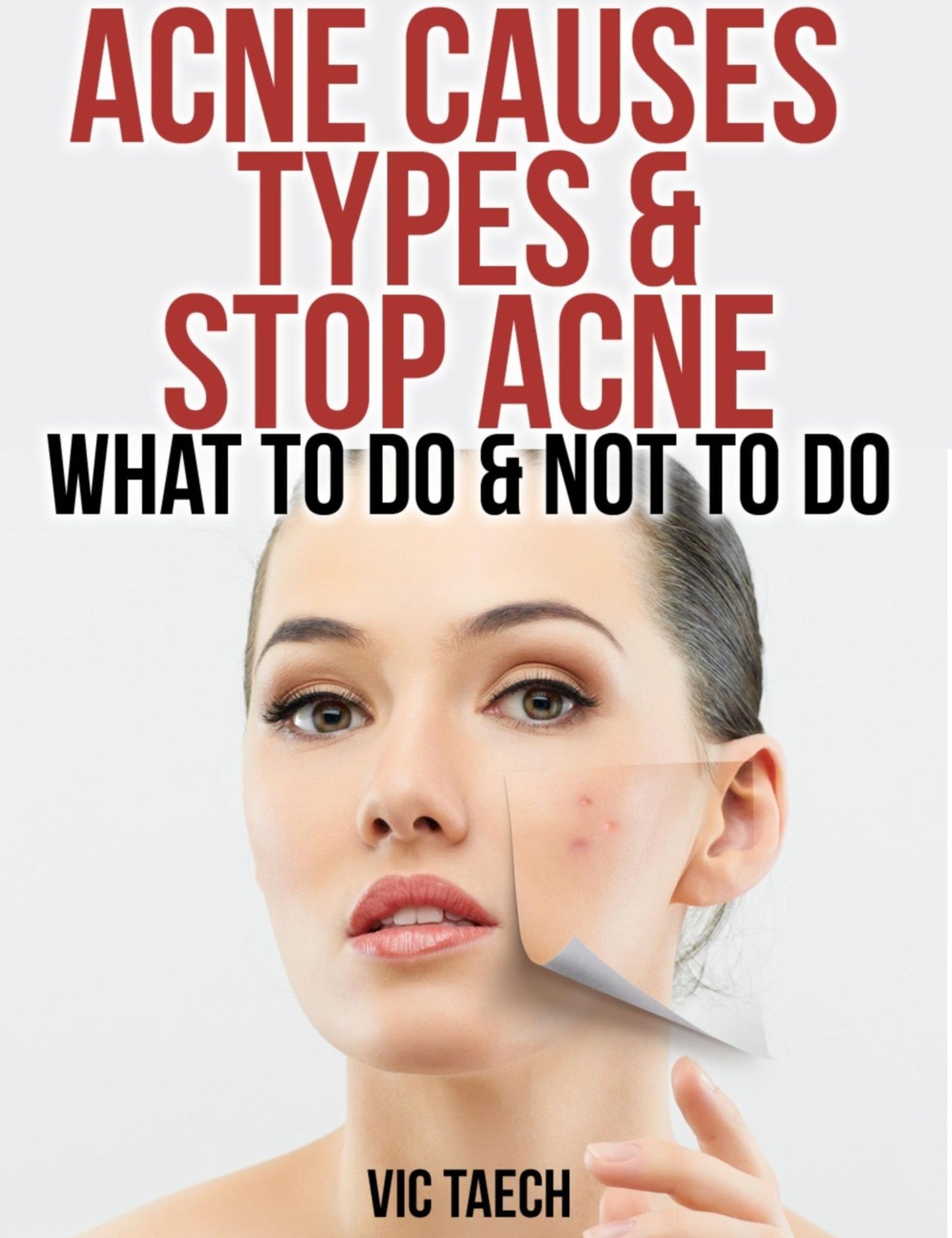 Acne Causes Types & Stop Acne: What to Do & Not to Do