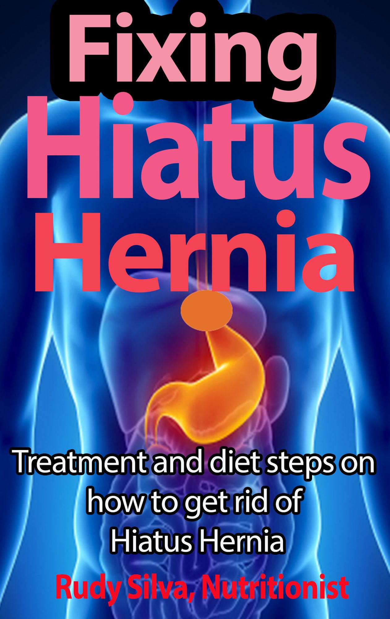 Hiatus Hernia: A Diet for Recovering From Hiatus Hernia