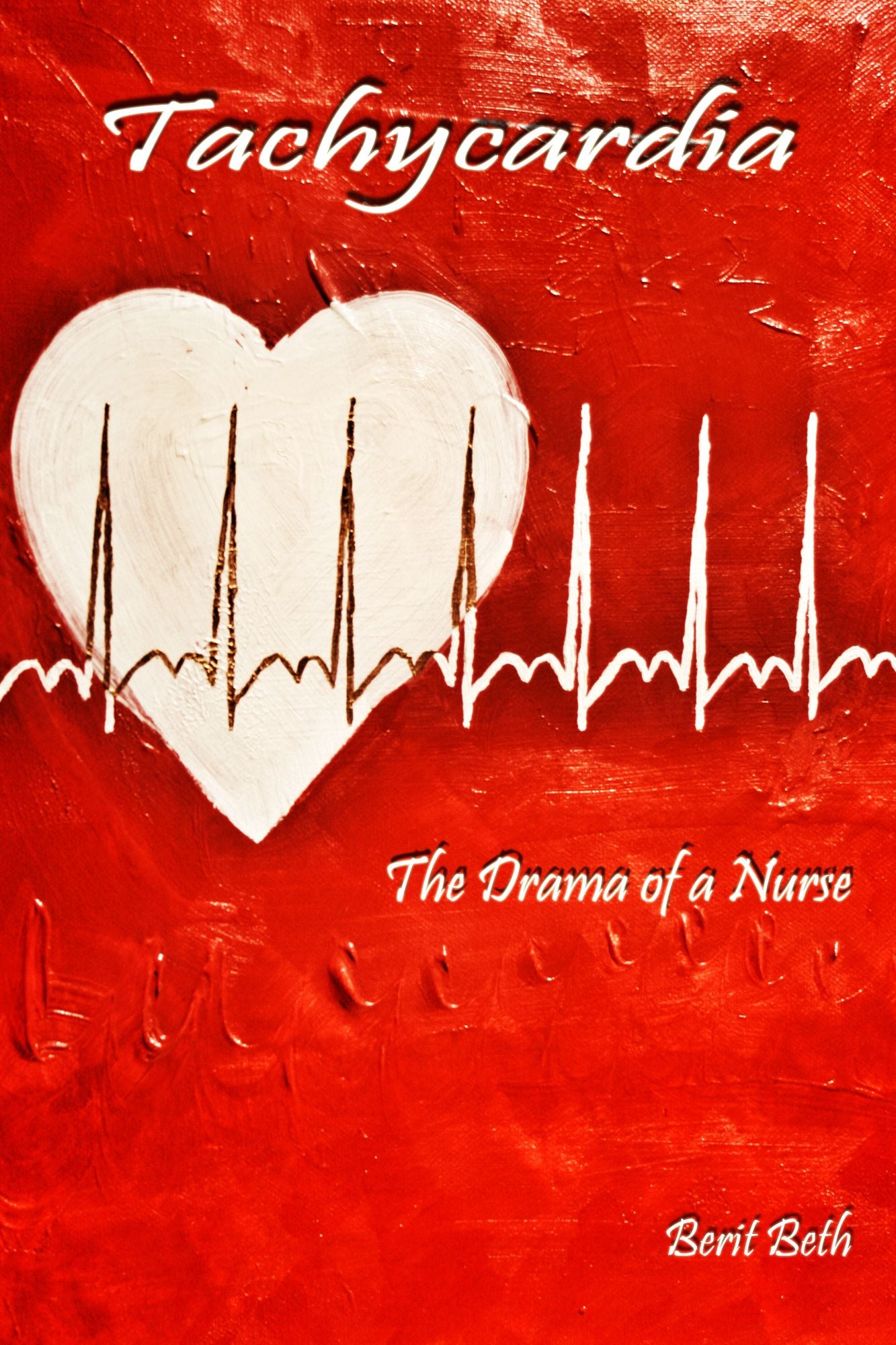 Tachycardia: The Drama of a Nurse