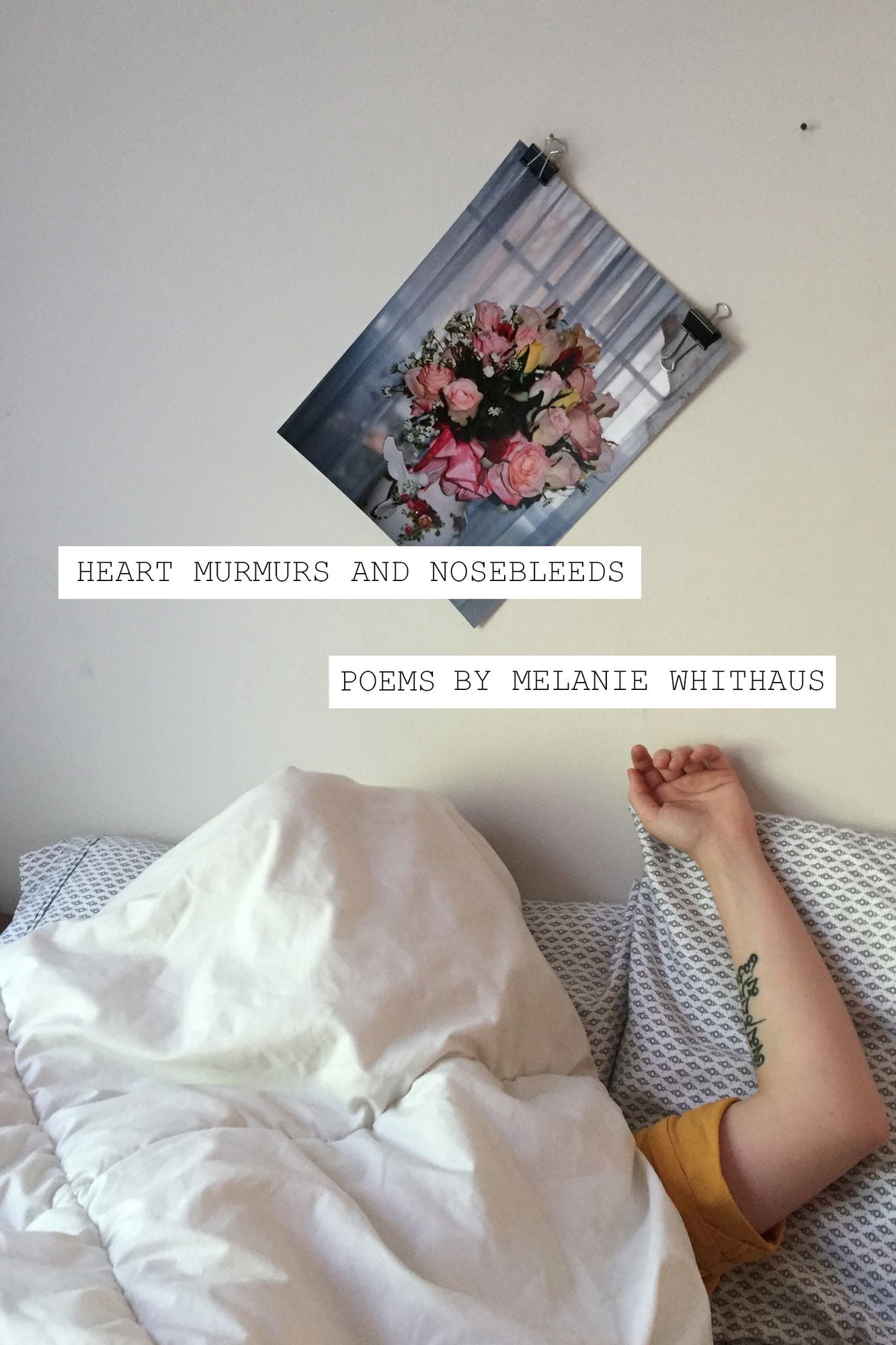Heart Murmurs and Nosebleeds
