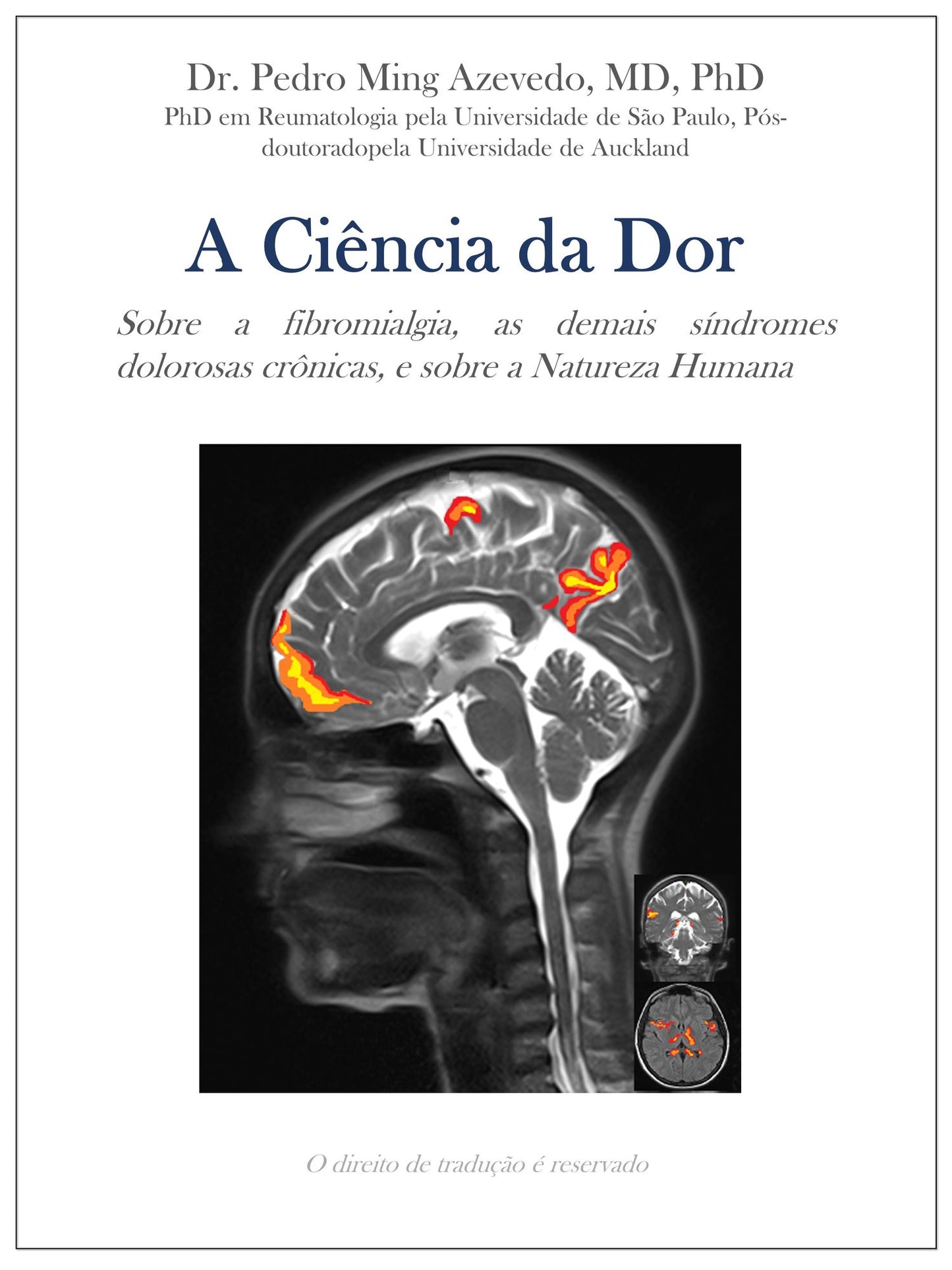 A Ciencia da Dor