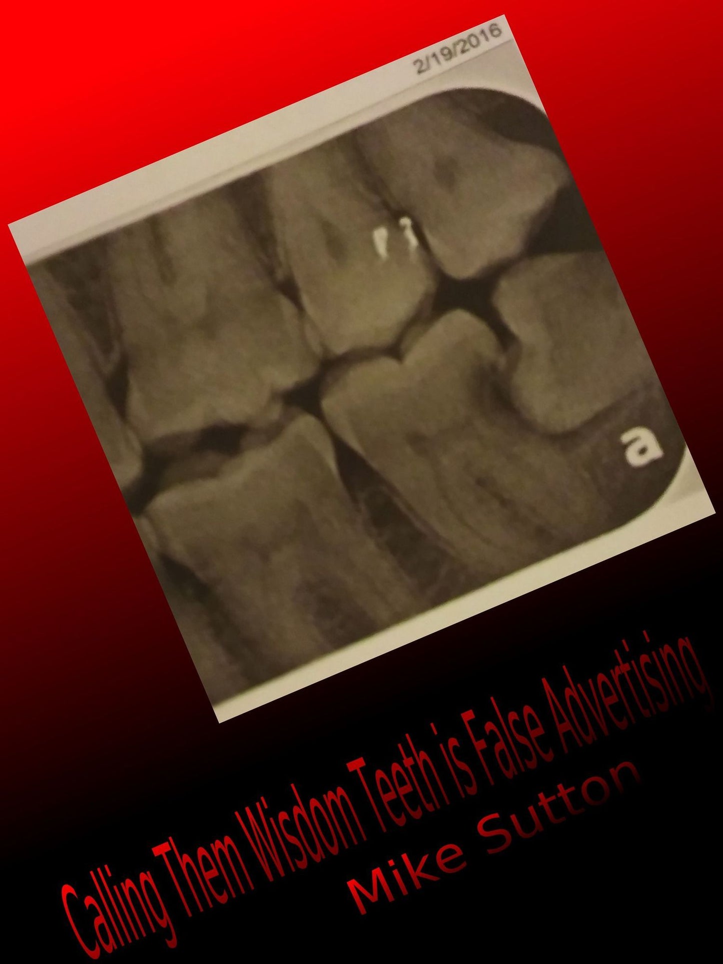 Calling them Wisdom Teeth is False Advertising