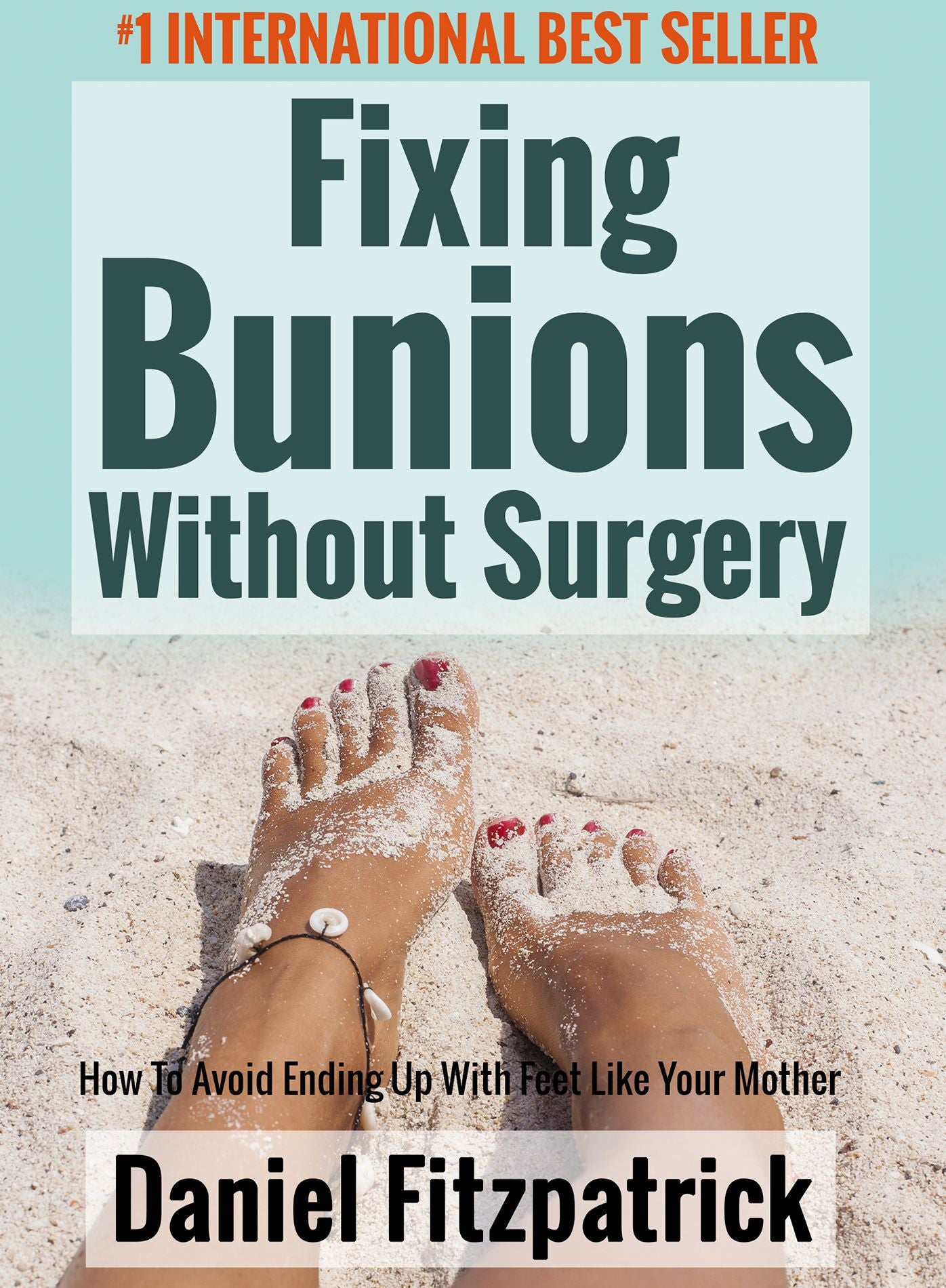 Fixing Bunions Without Surgery: How To Avoid Ending Up With Feet Like Your Mother