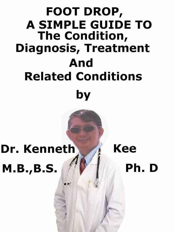 Foot Drop, A Simple Guide To The Condition, Diagnosis, Treatment And Related Conditions