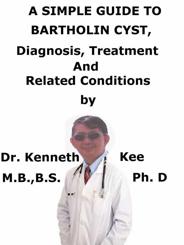 A Simple Guide To Bartholin Cyst, Diagnosis, Treatment And Related Conditions