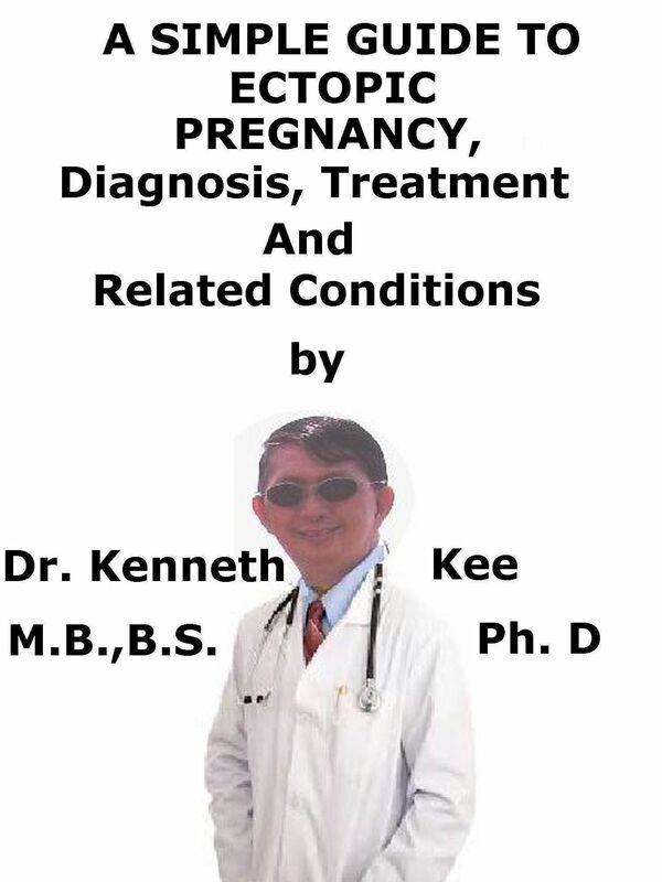 Ectopic Heartbeats, (Extrasystoles) A Simple Guide To The Condition, Diagnosis, Treatment And Related Conditions
