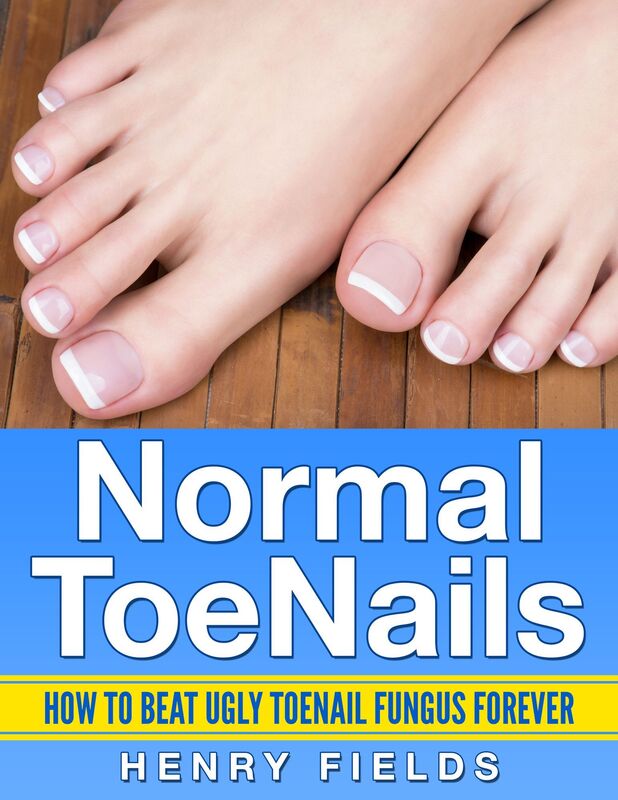 Normal ToeNails: How to Beat Ugly Toenail Fungus Forever