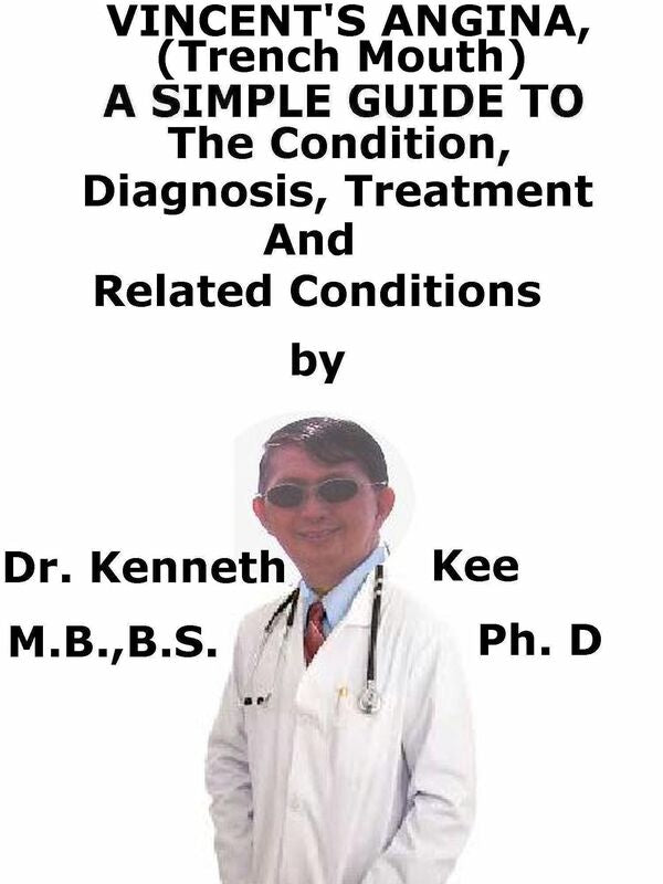 Vincent's Angina, (Trench Mouth) A Simple Guide To The Condition, Diagnosis, Treatment And Related Conditions