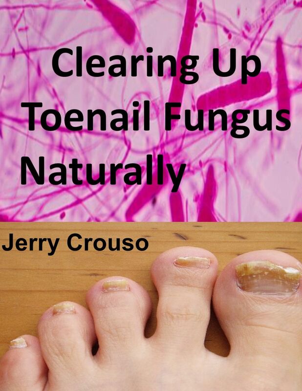 Clearing Up Toenail Fungus Naturally