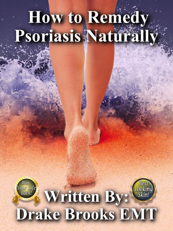 How to Remedy Psoriasis Away Naturally