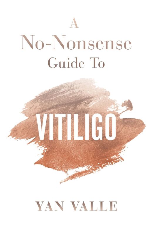 A No-Nonsense Guide To Vitiligo