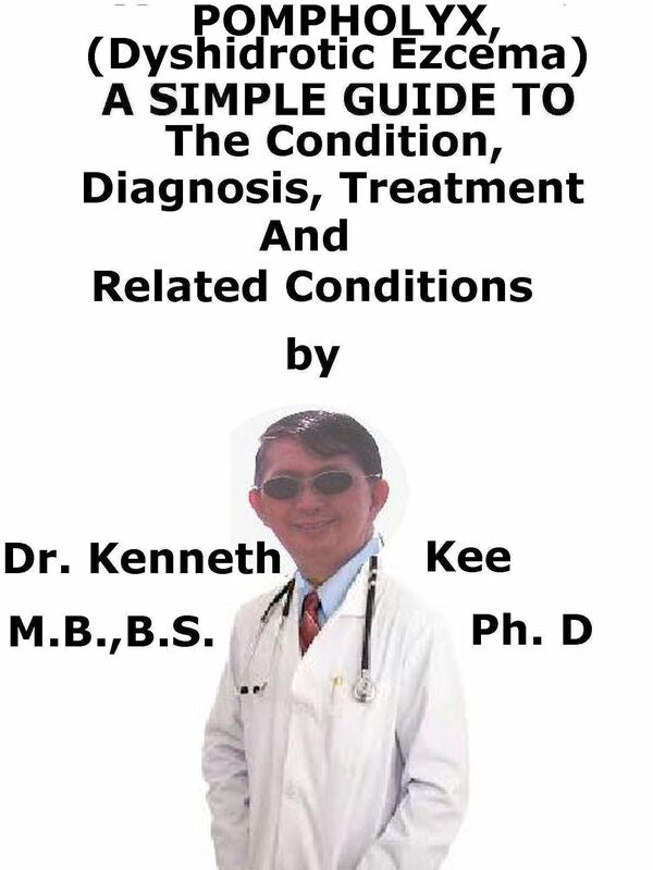 Pompholyx, (Dyshidrotic Ezcema) A Simple Guide To The Condition, Diagnosis, Treatment And Related Conditions