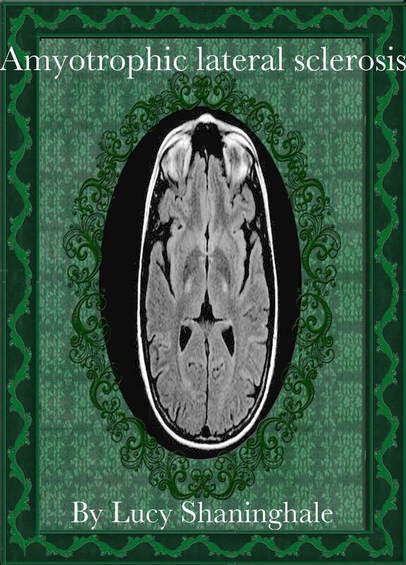 Amyotrophic lateral sclerosis