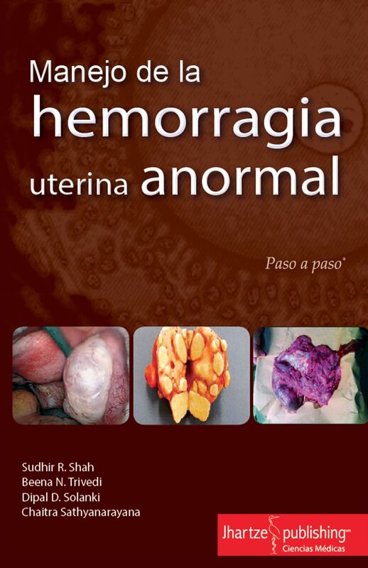 MANEJO DE LA HEMORRAGIA UTERINA ANORMAL, Paso a Paso