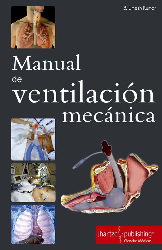 MANUAL DE VENTILACION MECANICA
