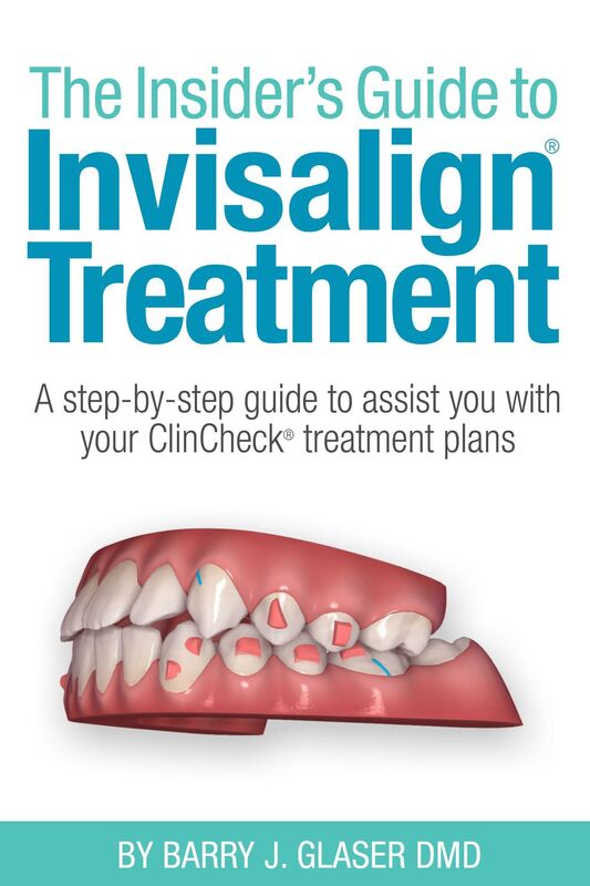 The Insider's Guide to Invisalign Treatment