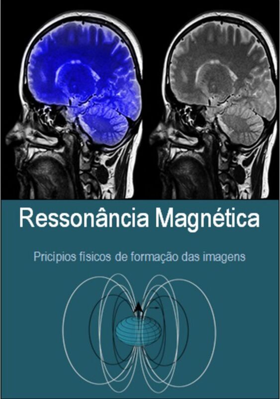 Ressonancia Magnetica