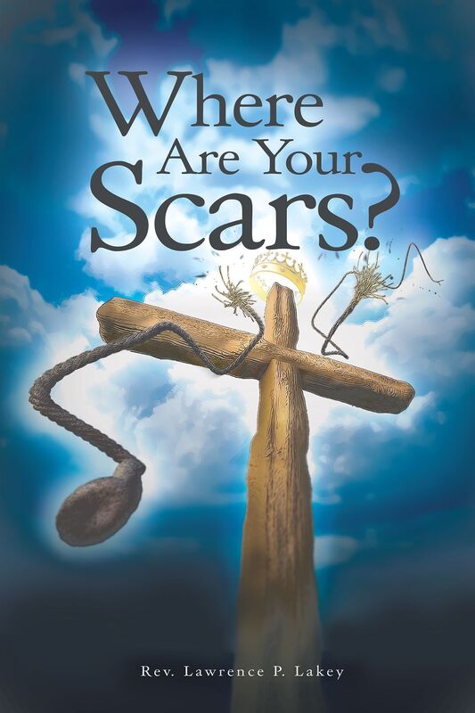 Where Scars?
