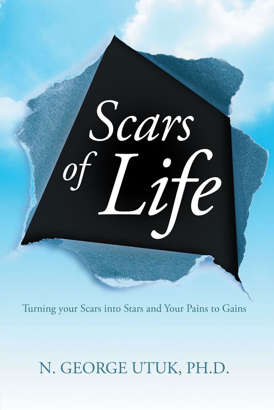 Scars of Life: Turning your Scars into Stars and Your Pains to Gains