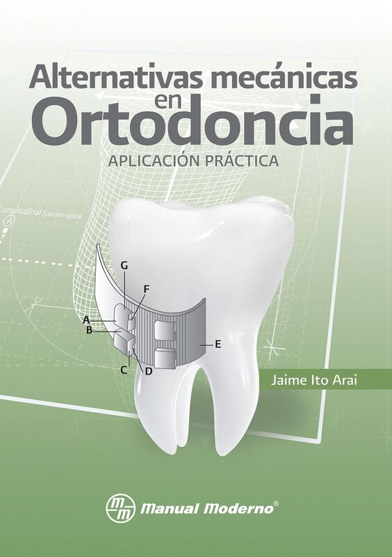 Alternativas mecanicas en Ortodoncia. Aplicacion practica