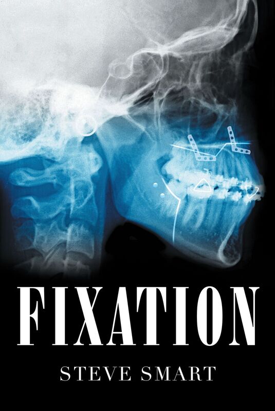 Fixation