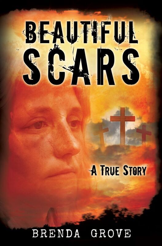 BEAUTIFUL SCARS