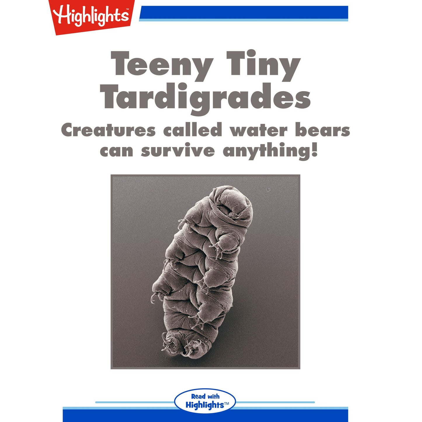 Teeny Tiny Tardigrades: Creatures called water bears can survive anything!