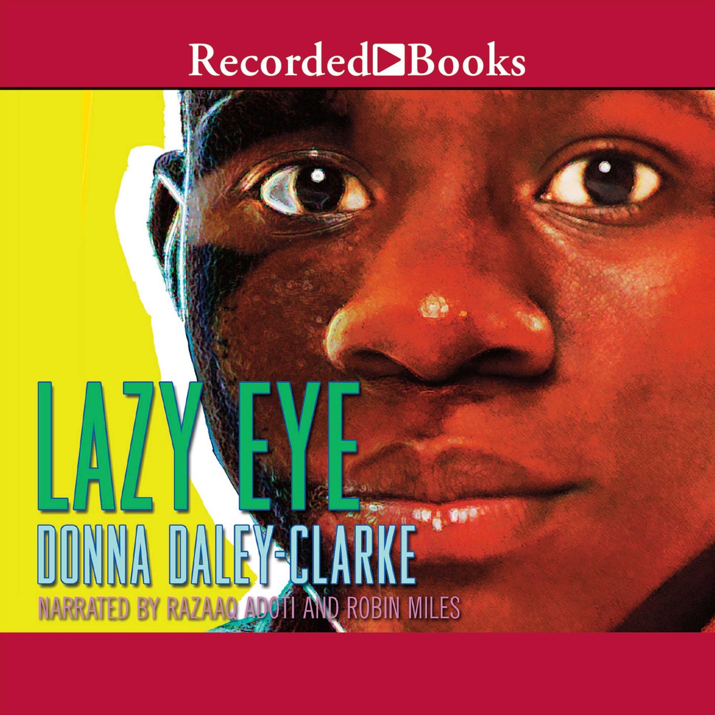 Lazy Eye
