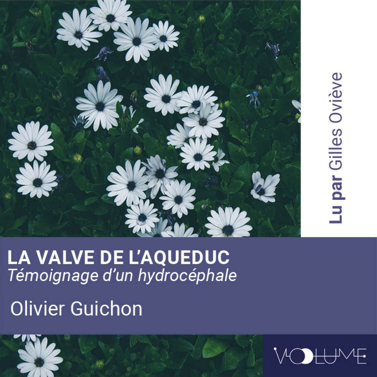 La valve de l'aqueduc: TÃ©moignage d'un hydrocÃ©phale
