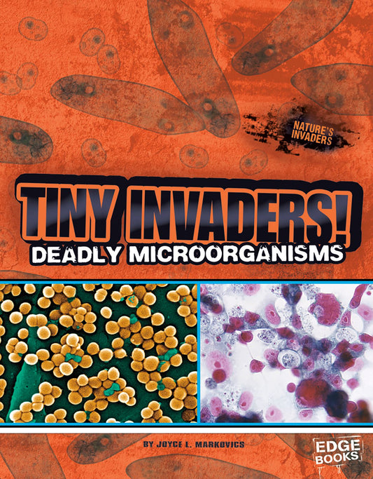 Tiny Invaders! : Deadly Microorganisms