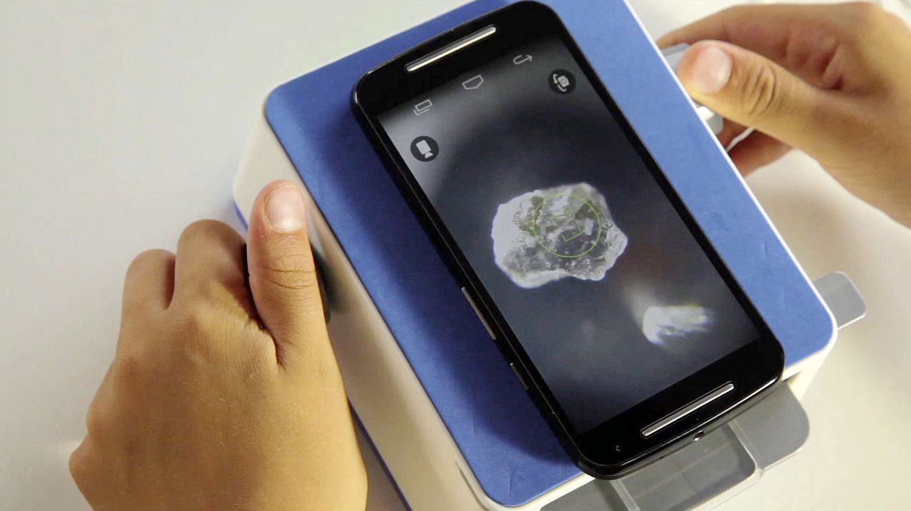Smartscope